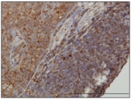 AM21028PU-N - WDR77 / MEP-50