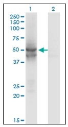 AM20902PU-N - Isocitrate dehydrogenase / IDH2