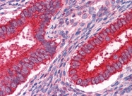 AM20908PU-N - Junction plakoglobin