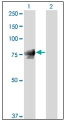 AM20908PU-N - Junction plakoglobin