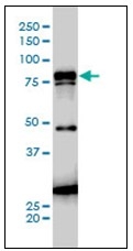 AM20908PU-N - Junction plakoglobin
