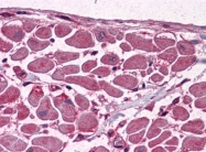 AM20916PU-N - MBNL1