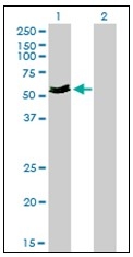 AM20919PU-N - Myocilin