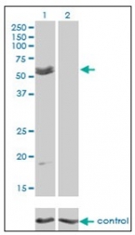 AM20919PU-N - Myocilin