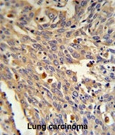 AP17424PU-N - Alpha-galactosidase A / GLA