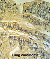 AP17383PU-N - FKBP2 / FKBP13
