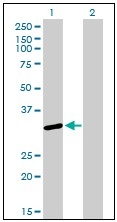 AM20942PU-N - U1 snRNP protein A