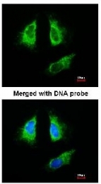 AP23582PU-N - 14-3-3 protein beta/alpha