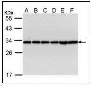 AP23582PU-N - 14-3-3 protein beta/alpha