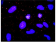 AM20948PU-N - CD156b / ADAM17