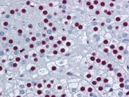 AM20956PU-N - Splicing factor 1 (SF1)