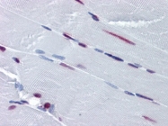 AM20956PU-N - Splicing factor 1 (SF1)