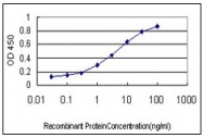 AM20956PU-N - Splicing factor 1 (SF1)