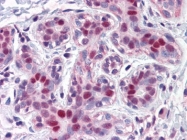 AM20959PU-N - LMO4