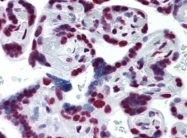 AM20963PU-N - CDKL1