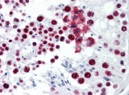 AM20963PU-N - CDKL1