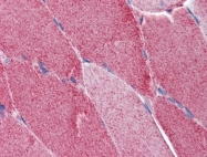 AM20970PU-N - FAM50A