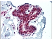 AM20512PU-N - HDAC1