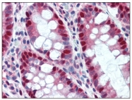 AM20512PU-N - HDAC1
