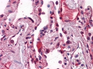 AM20867PU-N - CD324 / Cadherin-1