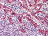 AM20867PU-N - CD324 / Cadherin-1