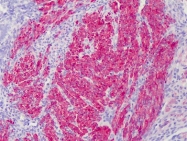 AM20872PU-N - Calponin-1