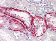 AM20875PU-N - Cathepsin K