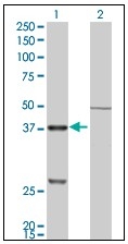 AM20875PU-N - Cathepsin K