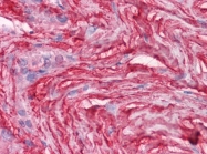 AM20879PU-N - Decorin