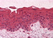 AM20888PU-N - G protein alpha inhibitor 1