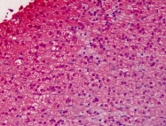 AM20888PU-N - G protein alpha inhibitor 1