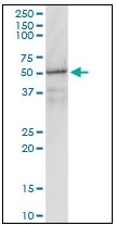AM20888PU-N - G protein alpha inhibitor 1