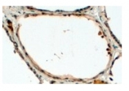 AP23774PU-N - Dual oxidase 1