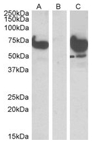 AP23768PU-N - EPM2AIP1