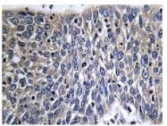 AP06599PU-N - Doublecortin