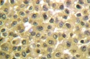 AP06307PU-N - RAR-beta / RARB