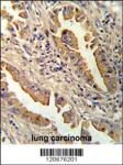 AP18073PU-N - Interleukin-8 / IL8