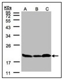 AP23605PU-N - Stathmin / STMN1