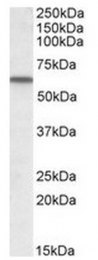 AP23687PU-N - Vitamin D-binding protein