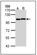 AP23620PU-N - Alpha-actinin-2 / ACTN2