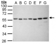 AP23778PU-N - XRCC4
