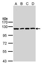 AP23623PU-N - Insulin-degrading enzyme