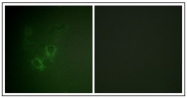 AP23638PU-N - Ah receptor / AhR