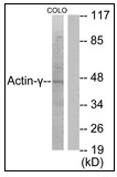 AP23639PU-N - gamma 2 smooth muscle Actin / ACTG2