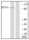 AP23643PU-N - ST14 / Matriptase