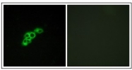 AP23647PU-N - FSH Receptor