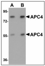 AP23517PU-N - APC4 / ANAPC4