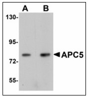 AP23518PU-N - APC5 / ANAPC5