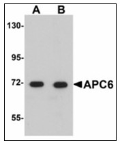 AP23519PU-N - CDC16 / APC6