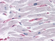 AP23549PU-N - SLAIN1